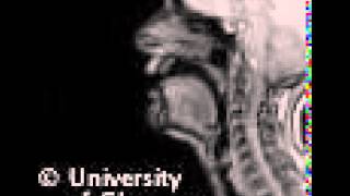 MRI voiced pharyngeal fricative [upl. by Madoc474]