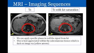 Introduction to Radiology Magnetic Resonance Imaging [upl. by Llennahc537]