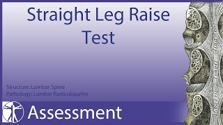 Clinical testing extraocular muscles tutorial [upl. by Miguela992]