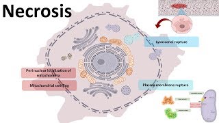 Necrosis  cellular mechanism and types [upl. by Drawe399]