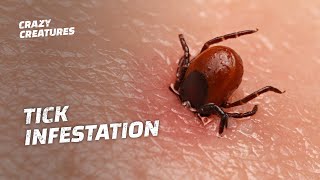 WARNING The Most Horrific Tick Infestations [upl. by Odnam]