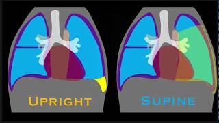 Respiratory System 7 Pleural membranes teaching demonstration [upl. by Arratal113]