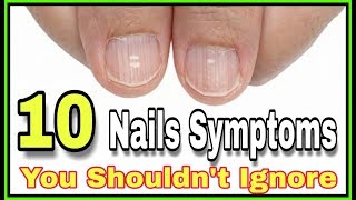 10 Nail Symptoms and What They Mean for Your Health You Shouldnt Ignore [upl. by Atikat]