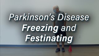 Parkinsons Disease Freezing amp Festinating Gait [upl. by Nyrtak]