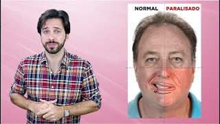 SINTOMAS DO AVC  Acidente Vascular Cerebral [upl. by Monroe]