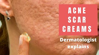 Acne Scar Creams  Dermatologist Reviews [upl. by Harrell]