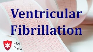 How to perform Cardioversion and Defibrillation [upl. by Nyvets862]