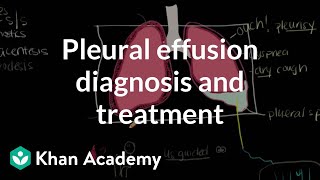 Pleural mass vs extrapleural vs pulmonary mass [upl. by Auhsoj]