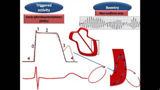 ECG course Torsades de Pointes Dr Sherif Altoukhy [upl. by Nyltak401]