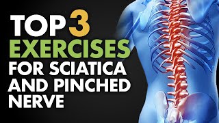 Pinched Nerve Cervical Radiculopathy Stretches amp Exercises  Ask Doctor Jo [upl. by Haseefan476]