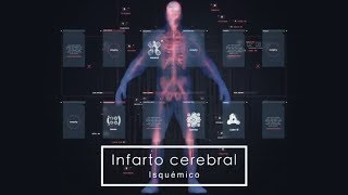 Infarto cerebral isquémico Síntomas y causas [upl. by Leasa247]