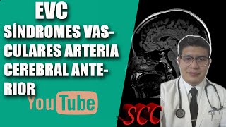 SÍNDROMES VASCULARES ARTERIA CEREBRAL ANTERIOR [upl. by Ynnos]