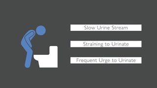 Trouble Urinating What Causes Urinary Issues in Men [upl. by Melborn]