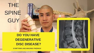 Lumbar Degenerative Disc Disease Part 1 Symptoms and Imaging [upl. by Cicero]