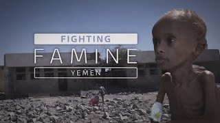 Yemen suffering worlds largest humanitarian crisis [upl. by Maury]