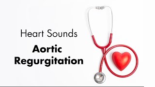 Aortic Regurgitation  Heart Sounds  MEDZCOOL [upl. by Amihsat]