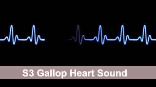 S3 Gallop Heart Sound Collection For Auscultation Skills [upl. by Schellens]